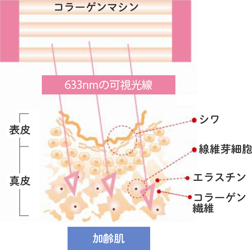 コラーゲンマシンのしくみ:図1